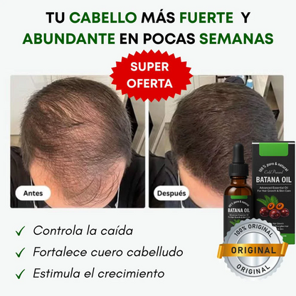 ✨🍀Aceite Batana ORIGINAL: El Secreto Ancestral para Prevenir la Caída del Cabello y Estimular el Crecimiento ✔